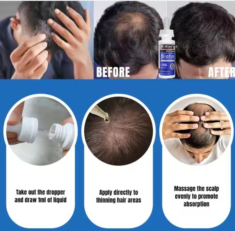 Biotin Serum Advance Hair  Treatment 60ml